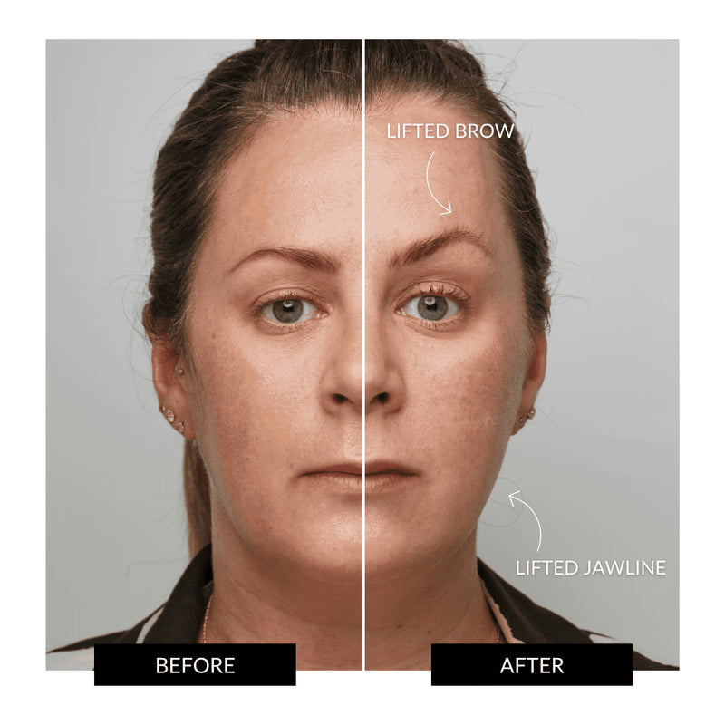 HALO Facial Toning Device