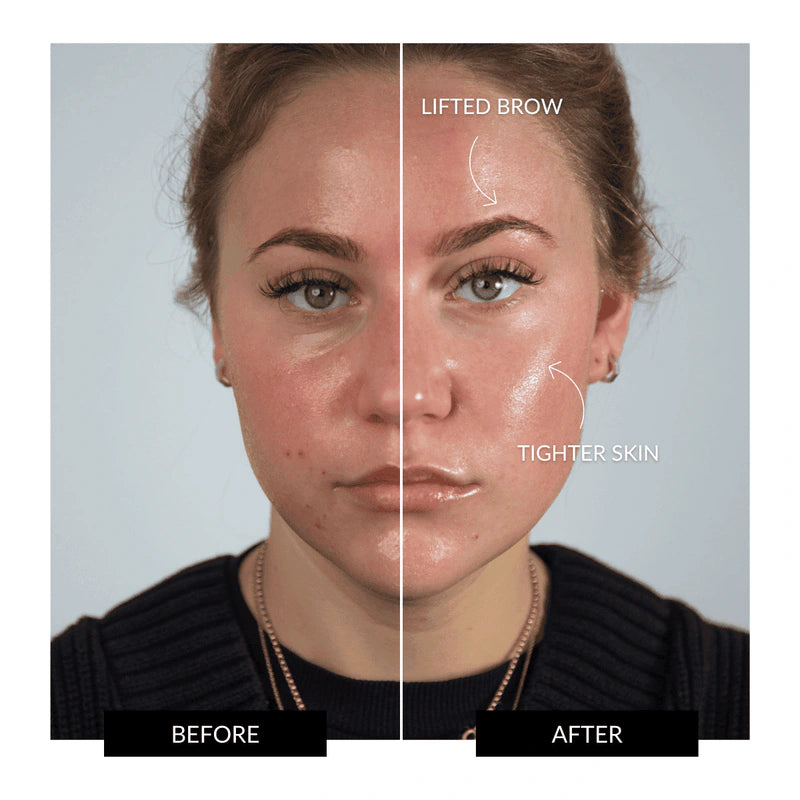 HALO Facial Toning Device