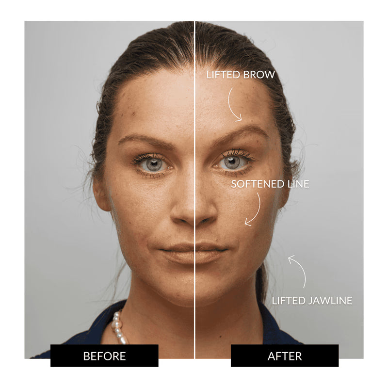HALO Facial Toning Device