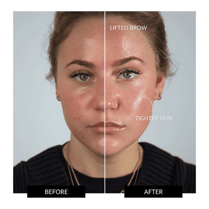 HALO Facial Toning Device